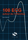 100 ECG infarctus